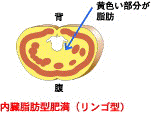 内蔵脂肪型肥満（りんご型）